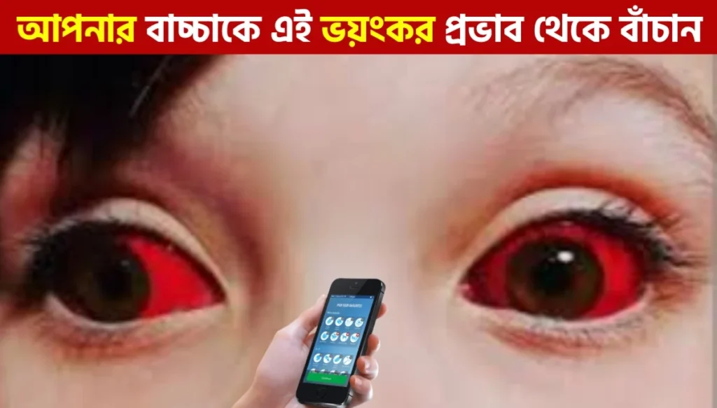 মোবাইল দেখার ফলে বাচ্চাদের চোখে যে ভয়ঙ্কর প্রভাব পড়ে | Mobile Side Effects